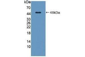 Detection of Recombinant C8g, Human using Polyclonal Antibody to Complement Component 8g (C8g) (C8G anticorps  (AA 39-202))