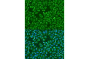 Immunofluorescence analysis of U2OS cells using IGF2BP1 antibody.