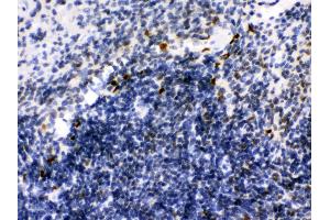 Anti- Ikaros Picoband antibody, IHC(P) IHC(P): Mouse Spleen Tissue (IKZF1 anticorps  (C-Term))