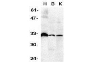 Western Blotting (WB) image for anti-Tumor Necrosis Factor Receptor Superfamily, Member 6b, Decoy (TNFRSF6B) (N-Term) antibody (ABIN2473237) (TNFRSF6B anticorps  (N-Term))