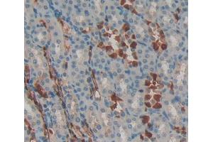 Figure. (IL-33 anticorps  (AA 5-108))