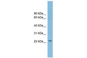 RNF125 antibody used at 1 ug/ml to detect target protein. (RNF125 anticorps  (Middle Region))