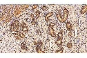 Detection of TDP43 in Porcine Uterus Tissue using Polyclonal Antibody to Tar DNA Binding Protein 43 kDa (TDP43)