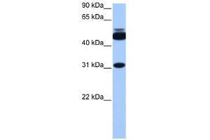 CYLC2 antibody used at 1 ug/ml to detect target protein.