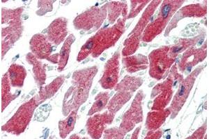 Human Heart (formalin-fixed, paraffin-embedded) stained with CRYAB antibody ABIN462098 at 10 µg/ml followed by biotinylated goat anti-rabbit IgG secondary antibody ABIN481713, alkaline phosphatase-streptavidin and chromogen. (CRYAB anticorps)