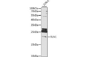 Western blot analysis of extracts of 22Rv1 cells, using RLN1 antibody (ABIN7269906) at 1:1000 dilution.