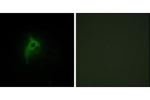 Immunofluorescence analysis of HepG2 cells, using Adrenergic Receptor alpha-2B antibody.