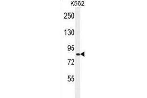 Western Blotting (WB) image for anti-Deafness, Autosomal Recessive 31 (DFNB31) antibody (ABIN2996024) (DFNB31 anticorps)