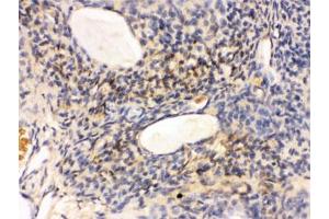 IHC testing of FFPE rat ovary tissue with GNAQ antibody.