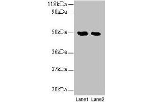 Western blot All lanes: LCAT antibody at 2 μg/mL Lane 1: EC109 whole cell lysate Lane 2: 293T whole cell lysate Secondary Goat polyclonal to rabbit IgG at 1/10000 dilution Predicted band size: 50 kDa Observed band size: 50 kDa (LCAT anticorps  (AA 25-433))