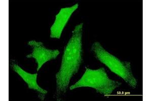 Immunofluorescence of monoclonal antibody to IL6 on HeLa cell.