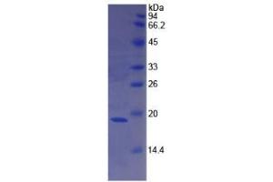 SDS-PAGE analysis of Human F8 Protein. (Factor VIII Protéine)