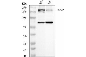Western blot analysis of SBNO1 using anti-SBNO1 antibody (ABIN7601710). (SBNO1 anticorps  (AA 43-1303))