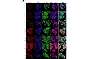Intracellular location of HMGB1 in HeLa cells at the basal state and in response to treatment with LPS, VPA and OH-VPA(A) HMGB1 protein (red) increased in cells that received any of the treatments. (HMGB1 anticorps)