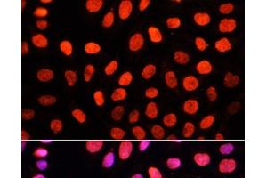 Immunofluorescence analysis of HeLa cells using DiMethyl-DNMT3A-K44 Polyclonal Antibody at dilution of 1:100. (DNMT3A anticorps  (2meLys44))