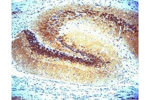 Immunohistochemical staining of CaM Kinase II on rat brain (center panel). (CAMK2A anticorps  (AA 448-460))