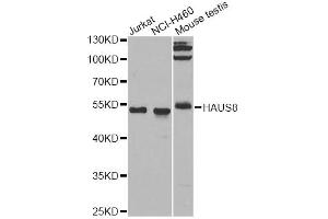 Western blot analysis of extracts of various cell lines, using HAUS8 antibody. (NYS48/HAUS8 anticorps)
