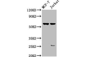 Western Blot Positive WB detected in: MCF-7 whole cell lysate, Jurkat whole cell lysate All lanes: STRA8 antibody at 3. (STRA8 anticorps  (AA 115-241))