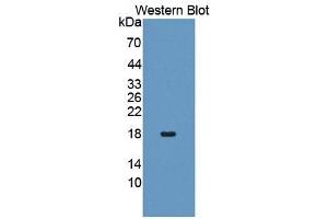 WB of Protein Standard: different control antibodies against Highly purified E. (FAS Kit CLIA)