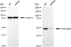 Western blotting analysis using PPP2R5E antibody (ABIN7800024).
