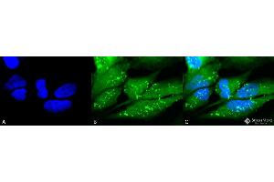 Immunocytochemistry/Immunofluorescence analysis using Rabbit Anti-p38 Polyclonal Antibody . (MAPK14 anticorps  (FITC))