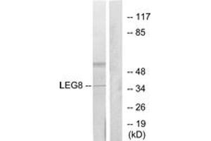 Western blot analysis of extracts from NIH-3T3 cells, using LEG8 Antibody. (LGALS8 anticorps  (AA 61-110))