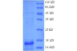SDS-PAGE (SDS) image for Hemoglobin, alpha 1 (HBA1) (AA 2-142) protein (His tag) (ABIN5709647)