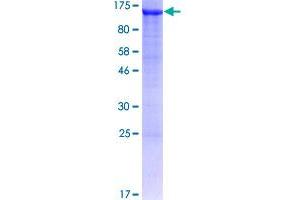 Image no. 1 for Adaptor-Related Protein Complex 1, beta 1 Subunit (AP1B1) (AA 1-939) protein (GST tag) (ABIN1345225)