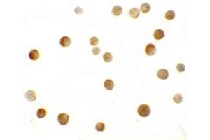 Immunohistochemistry (IHC) image for anti-Zinc Finger, MYM-Type 2 (ZMYM2) (C-Term) antibody (ABIN1030825)