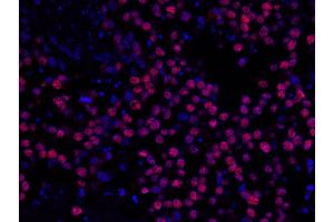 Immunofluorescence (IF) image for anti-Minichromosome Maintenance Complex Component 2 (MCM2) (AA 1-50) antibody (ABIN7448987) (MCM2 anticorps  (AA 1-50))