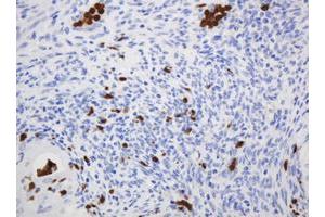 Image no. 1 for anti-CNKSR Family Member 3 (CNKSR3) antibody (ABIN1497550)