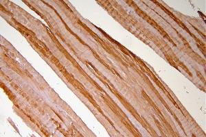 IHC analysis of Hsp20 using anti-Hsp20 antibody (ABIN5518920). (HSPB6 anticorps  (AA 73-123))