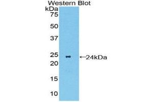 Western Blotting (WB) image for anti-Macrophage Stimulating 1 Receptor (C-Met-Related tyrosine Kinase) (MST1R) (AA 89-275) antibody (ABIN3206490) (MST1R anticorps  (AA 89-275))