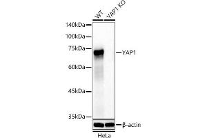 Western blot analysis of extracts from wild type(WT) and Y knockout (KO) HeLa cells, using Y antibody (ABIN7271418) at 1:20000 dilution.