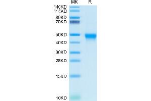 Human CD84 on Tris-Bis PAGE under reduced condition. (CD84 Protein (CD84) (AA 22-225) (His-Avi Tag))