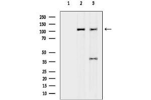 anti-DEAH (Asp-Glu-Ala-His) Box Polypeptide 34 (DHX34) antibody