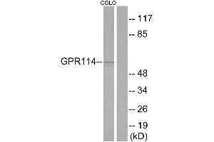 Western blot analysis of extracts from COLO cells, using GPR114 antibody. (GPR114 anticorps  (Internal Region))