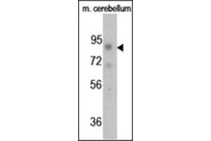Image no. 3 for anti-Fibroblast Growth Factor Receptor 1 (FGFR1) (pTyr766) antibody (ABIN358128)