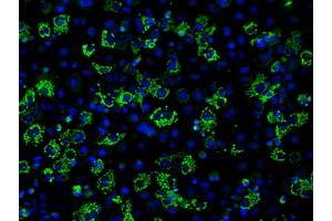 Image no. 2 for anti-Aconitase 2, Mitochondrial (ACO2) antibody (ABIN1496412) (ACO2 anticorps)