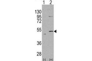 Western Blotting (WB) image for anti-Aldehyde Dehydrogenase 5 Family, Member A1 (ALDH5A1) antibody (ABIN2998188) (ALDH5A1 anticorps)
