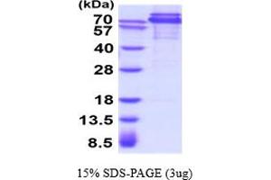 SDS-PAGE (SDS) image for Cadherin 1, Type 1, E-Cadherin (Epithelial) (CDH1) (AA 23-709) protein (His tag) (ABIN5854522)