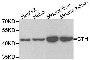 Western blot analysis of extracts of various cell lines, using CTH antibody. (CTH anticorps  (AA 1-405))