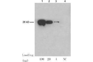 Lane 1-3: 100 ng, 20 ng, 4 ng GST fusion protein Lane 4: NC: E. (GST anticorps)