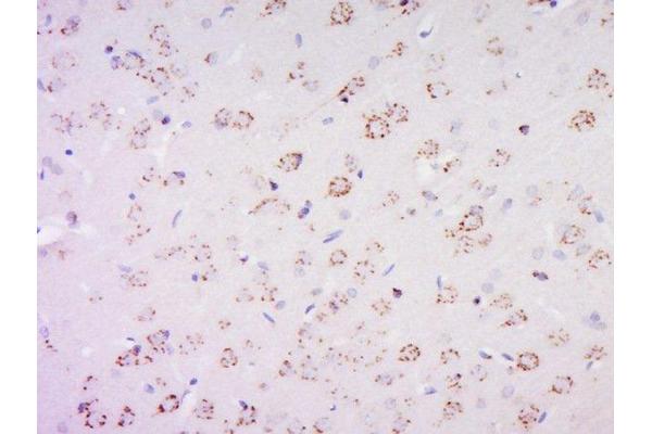 PAS1C1 anticorps