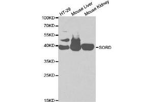 Western blot analysis of extracts of various cell lines, using SORD antibody. (SORD anticorps  (AA 1-357))
