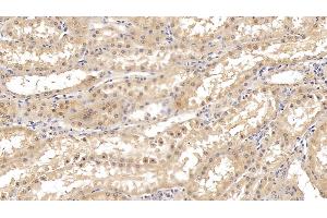 Detection of FAPa in Human Kidney Tissue using Monoclonal Antibody to Fibroblast Activation Protein Alpha (FAPa)