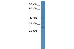 WB Suggested Anti-GCH1 Antibody Titration: 0. (GCH1 anticorps  (C-Term))