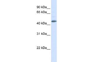 WB Suggested Anti-SNX5 Antibody Titration: 0. (SNX5 anticorps  (N-Term))