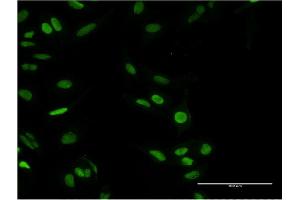 Immunofluorescence of monoclonal antibody to PARP1 on HeLa cell.