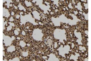 ABIN6277288 at 1/100 staining Mouse lung tissue by IHC-P. (Neural Wiskott-Aldrich syndrome protein (WASL) (Internal Region) anticorps)